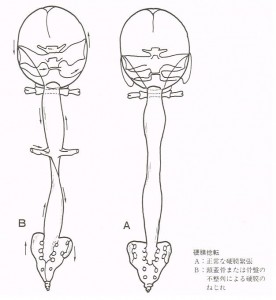 硬膜のねじれ【大阪　整体院エール　図】
