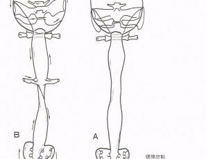 硬膜のねじれ【大阪　整体院エール　図】