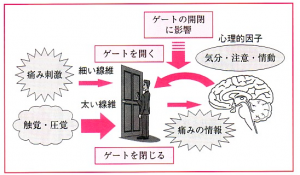 ゲートコントロールとは？