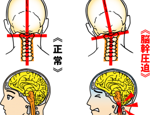 脳幹と自己治癒力【整体院エール】