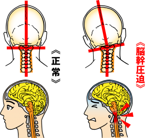 脳幹と自己治癒力【整体院エール】