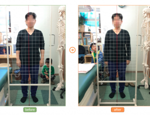 腰痛　ギックリ腰　堺市整体　ビフォーアフター