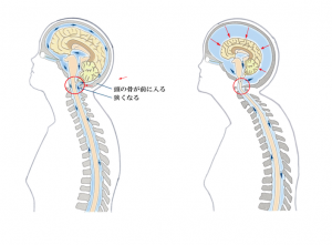 めまい・フラつき