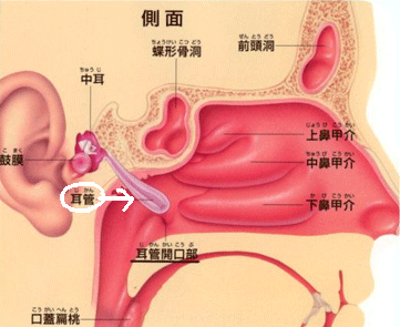 開放 原因 管 耳 症